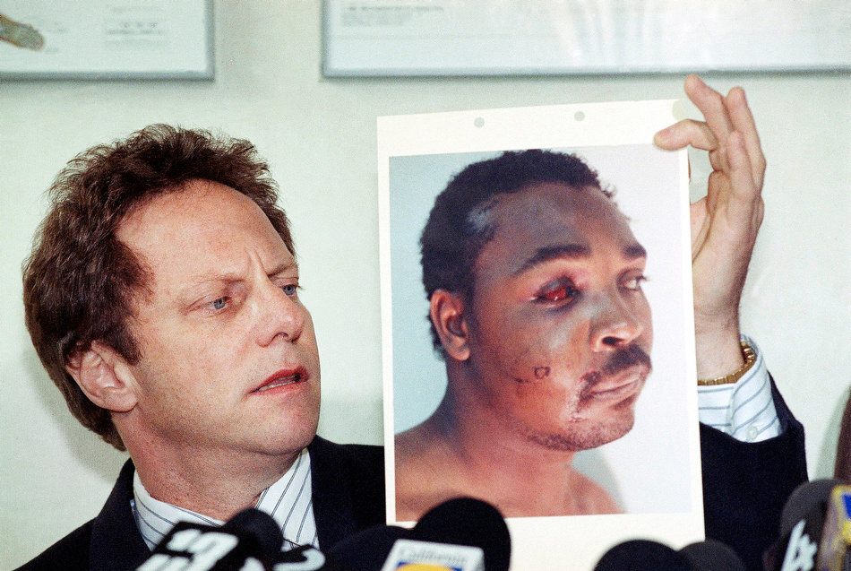 Luật sư của Rodney King công bố bức ảnh những vết thương thân chủ mình bị cảnh sát đánh đập.