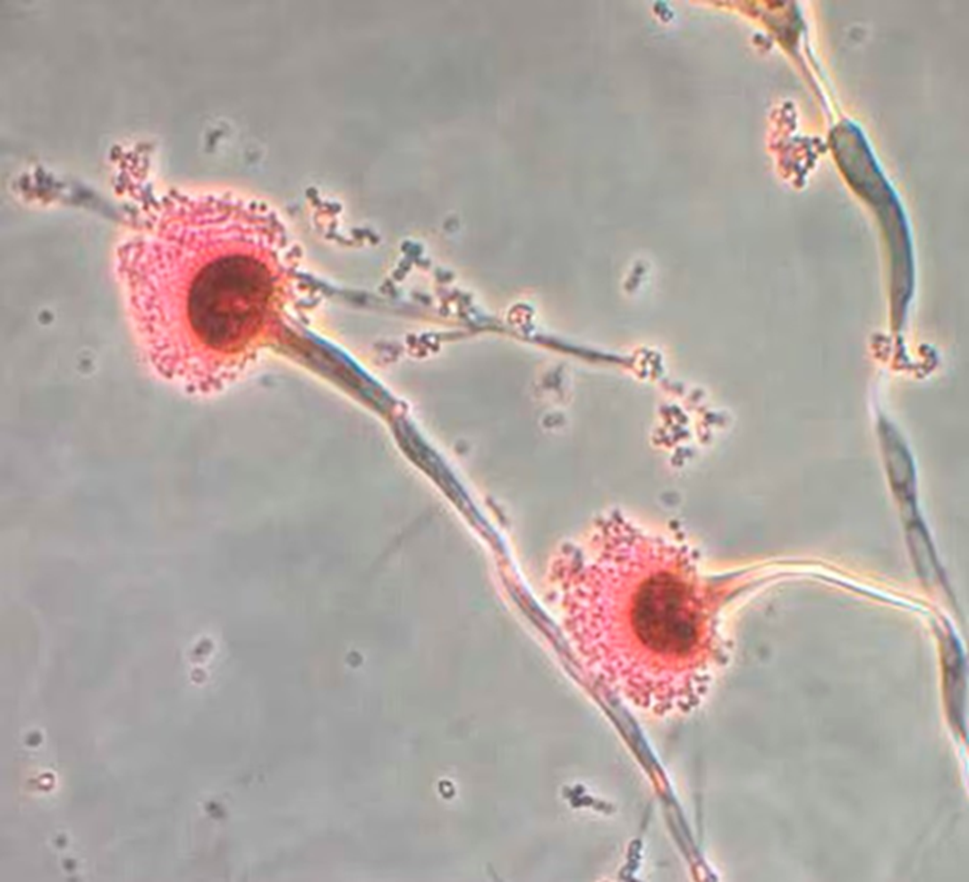 Nấm độc Aspergillus có thể sản sinh ra aflatoxin, một trong những chất gây ung thư tự nhiên mạnh nhất — Ảnh: Daily Mail