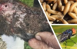 Mỹ phát hiện trường hợp đầu tiên nhiễm giun ăn thịt người