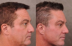 Nam giới Thung lũng Silicon chi trăm nghìn USD 'căng da' vì sợ hết thời Nam giới Thung lũng Silicon chi trăm nghìn USD 'căng da' vì sợ hết thời