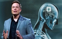 Công ty của Elon Musk được cấp phép cấy chip não ở người