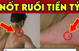 7 nốt ruồi là “thần may mắn”: Bất kể nam hay nữ có 1/7 Sướng Như Tiên