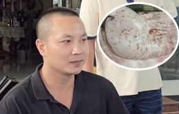 Đại diện C.P: Heo bệnh bị 'tố' đã được tiêu hủy