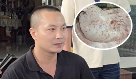 Đại diện C.P: Heo bệnh bị 'tố' đã được tiêu hủy