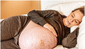 It’s unbelievable that photos of a mother of triplets’ enormous belly have gone viral