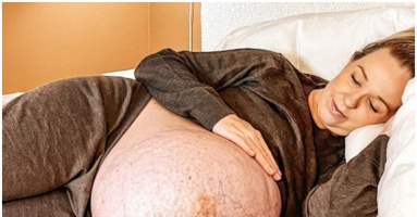 It’s unbelievable that photos of a mother of triplets’ enormous belly have gone viral