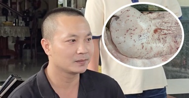 Đại diện C.P: Hình ảnh 'tố' heo bệnh là thật