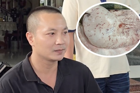 Đại diện C.P: Heo bệnh bị 'tố' đã được tiêu hủy